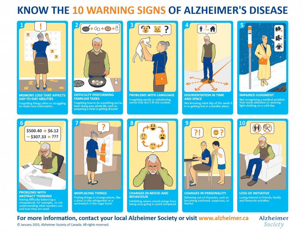 alzheimers disease image